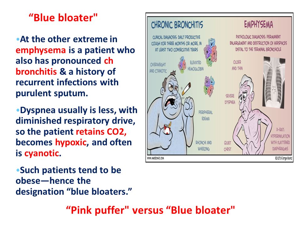 Lung Ch. 12 p (459 – 512) Feb ppt video online download