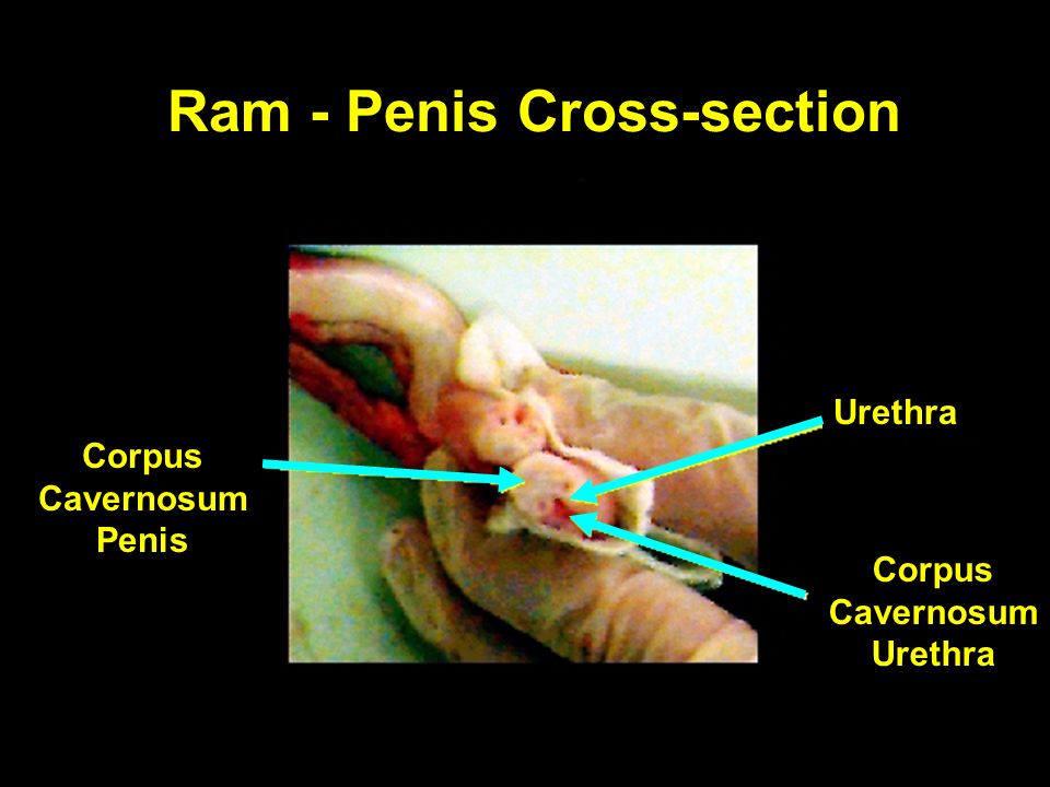 Ram - Scrotum Spermatic Cord External Cremaster Muscle Scrotum. - ppt video  online download