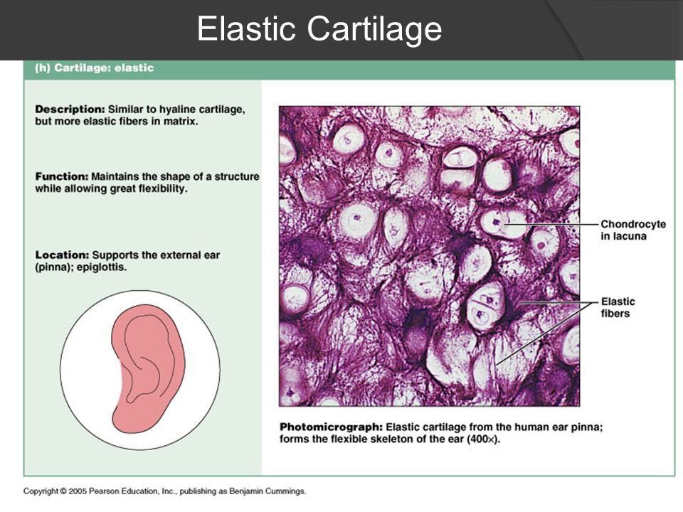 where would you find elastic cartilage