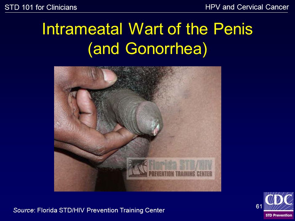 How dangerous is gonorrhea