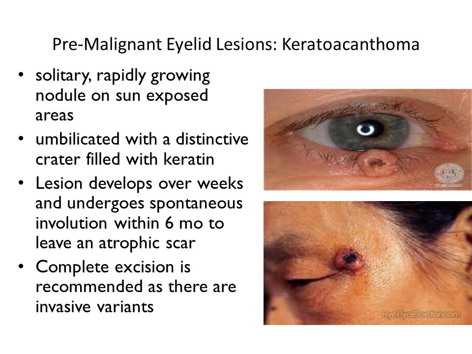Diagnosing and Managing Ocular Emergencies and Urgencies Diagnosing and Managing Ocular Emergencies and Urgencies