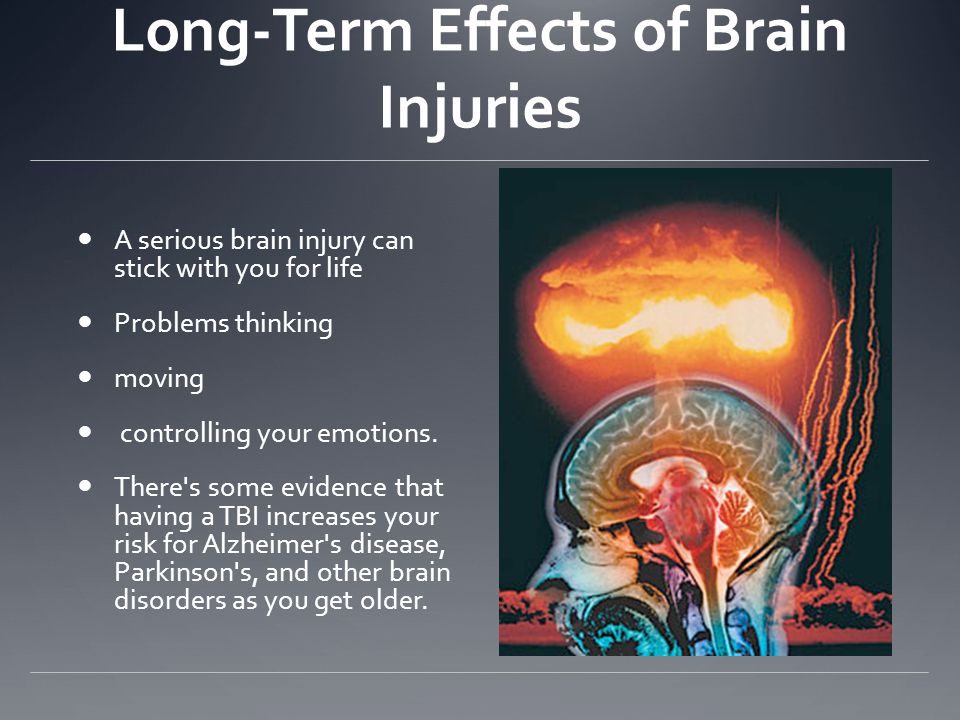Part 4 Concussions Causes blunt force trauma to the head fall - ppt video  online download