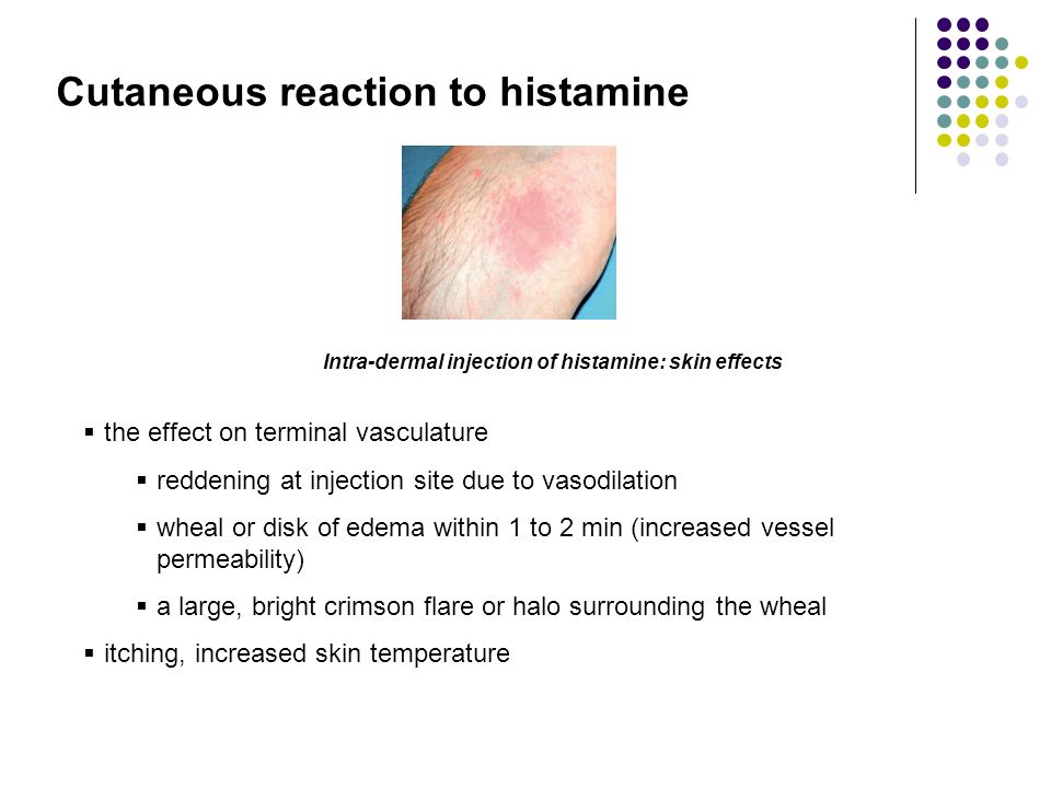 Histamine. Antihistamines - ppt download