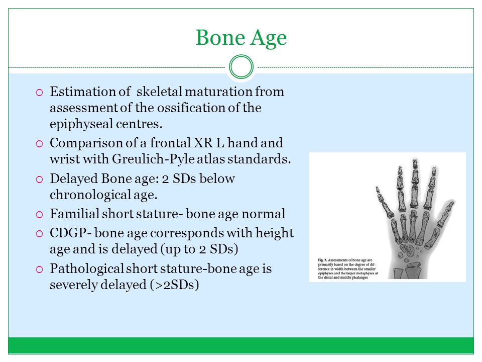 Bone Age Estimation Chart