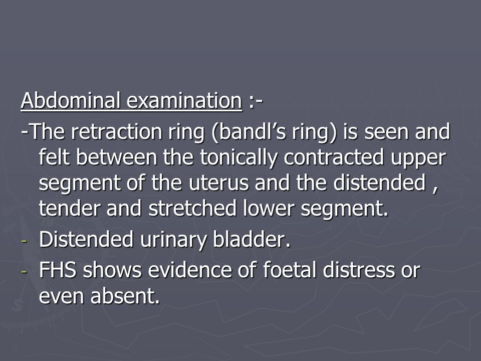 Bandl's Ring | PDF
