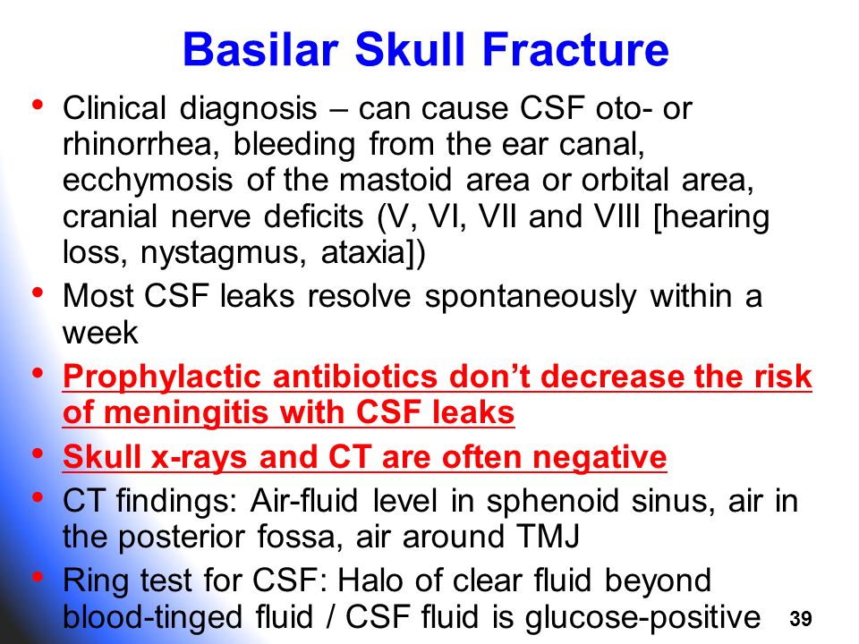 Image result for basilar skull fracture treatment