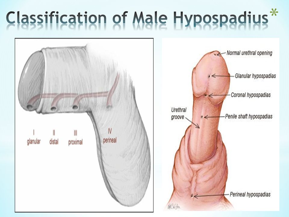 Urethral Disorder in Males - ppt video online download