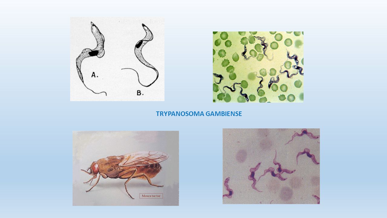 На рисунке изображено одно из проявлений жизнедеятельности. Трипаносома гамбиенсе. Trypanosoma brucei gambiense заболевание. Trypanosoma gambiense возбудитель. Trypanosoma brucei gambiense Сонная болезнь.