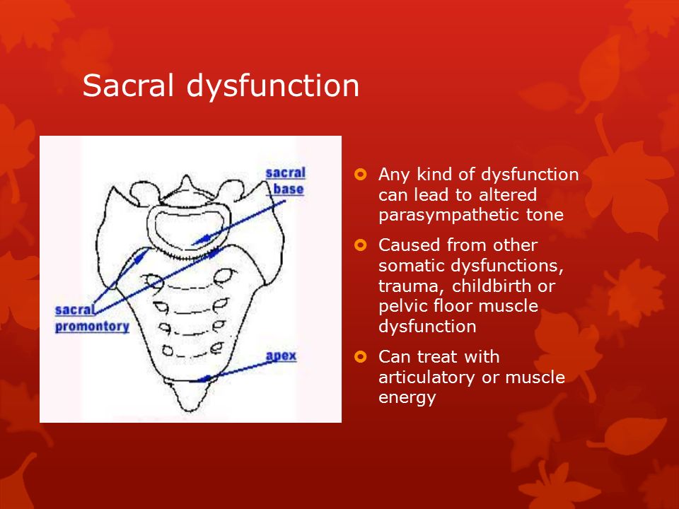 sacral somatic dysfunction