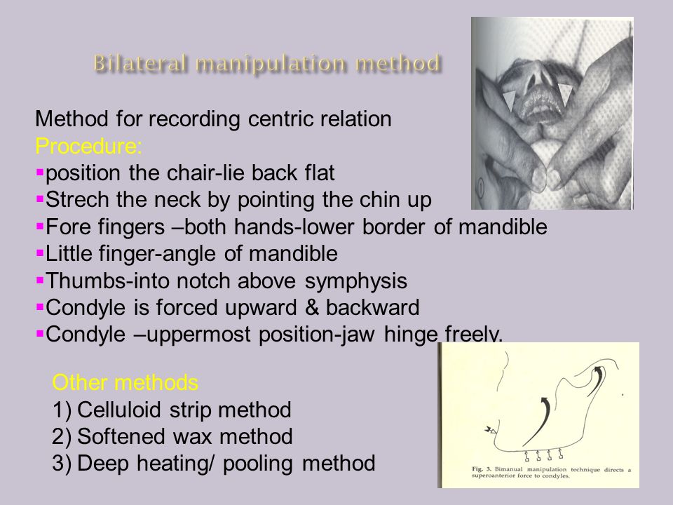 VERTICAL & HORIZONTAL JAW RELATIONS FOR COMPLETE DENTURE - ppt video online  download