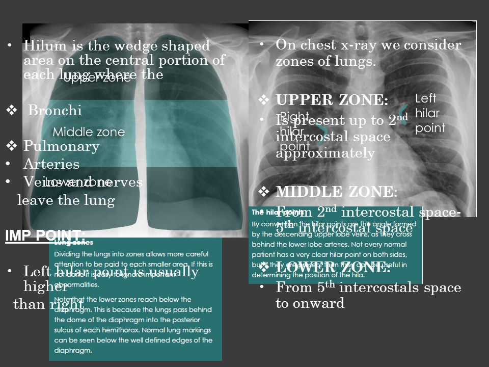Hilum is the wedge shaped area on the central portion of each lung where the