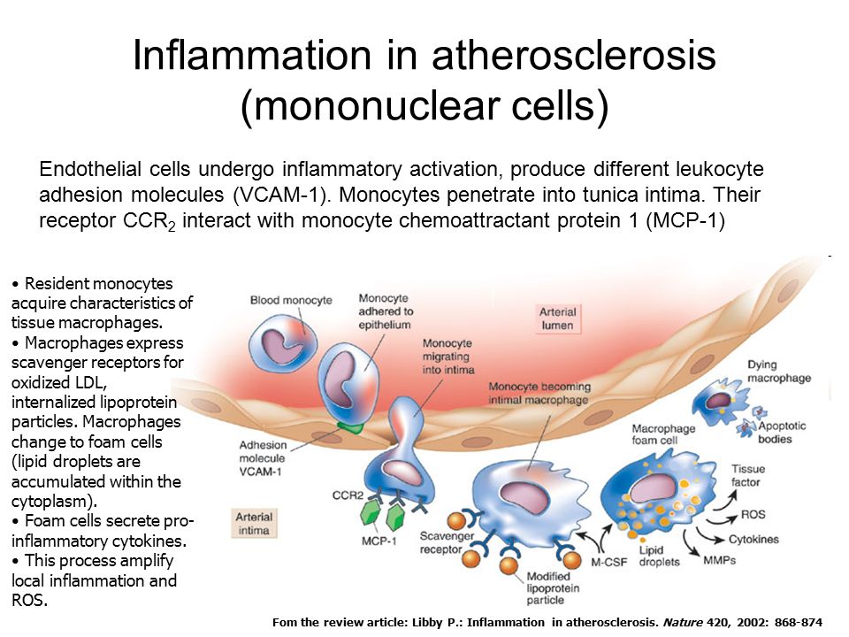 Atherosclerosis латынь. Atherosclerosis pathogenesis. Inflammation pathogenesis. Atherosclerosis inflammation. Поверхностные барьеры иммунология.