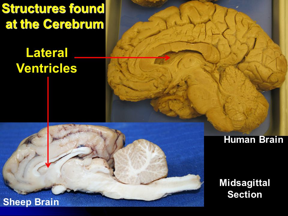 Midsagittal Sheep Brain