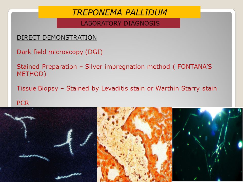 Treponema pallidum в рмп качественно