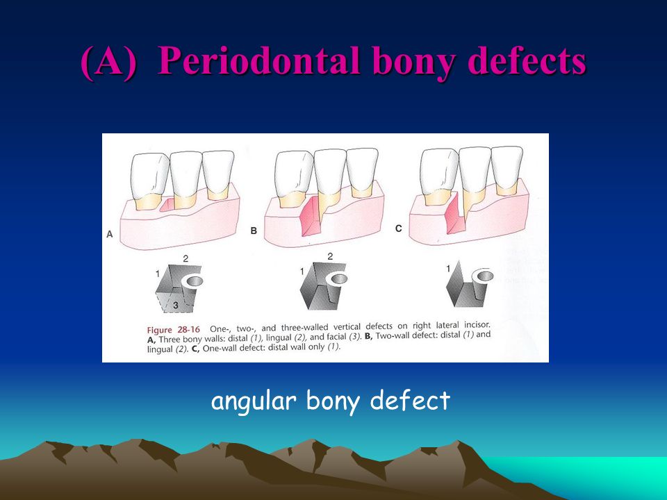 Ren Yeong Huang Dds Phd Ppt Video Online Download Ren Yeong Huang Dds Phd Ppt Video Online Download