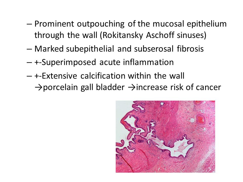 Disorders Of Gall Bladder Ppt Video Online Download