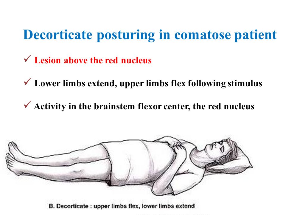 Approach To Coma Ppt Video Online Download