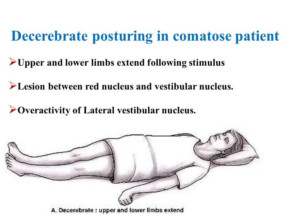 Approach To Coma Ppt Video Online Download Approach To Coma Ppt Video Online Download