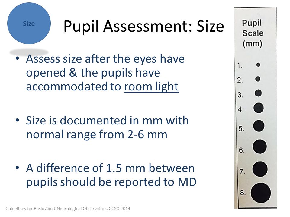 Pupil Assessment: Size