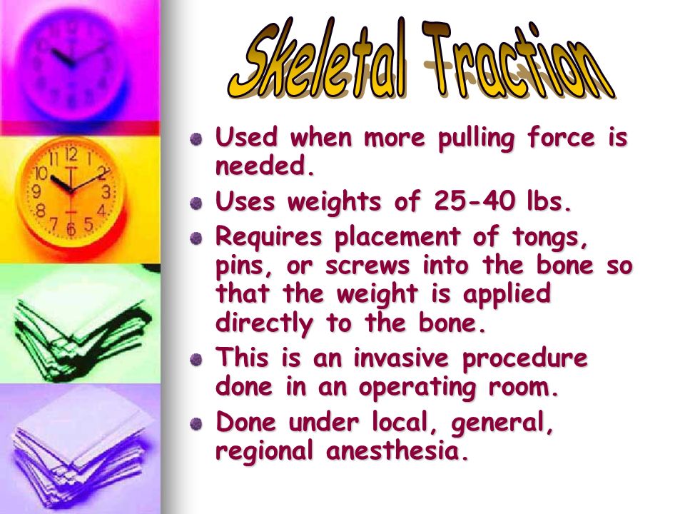Skeletal Traction Used when more pulling force is needed.