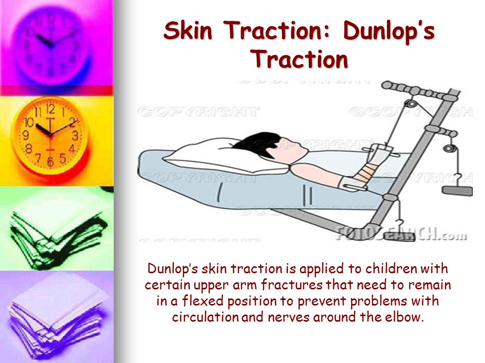 What is Dunlop traction? - Quora