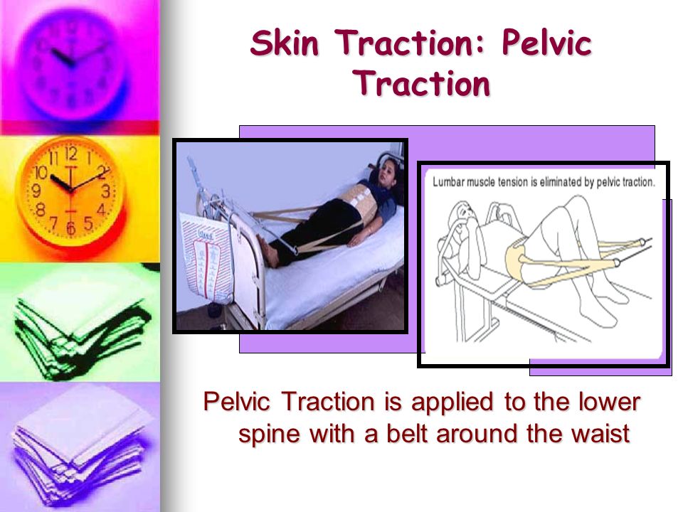 Skin Traction: Pelvic Traction