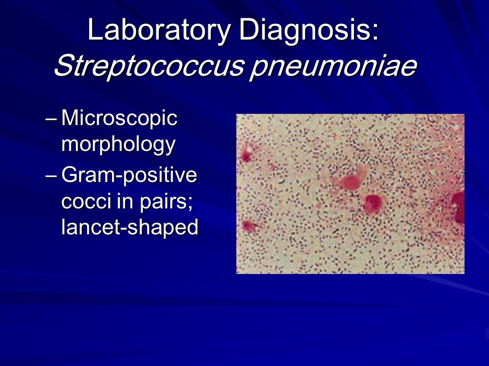 Laboratory Diagnosis: Streptococcus pneumoniae.