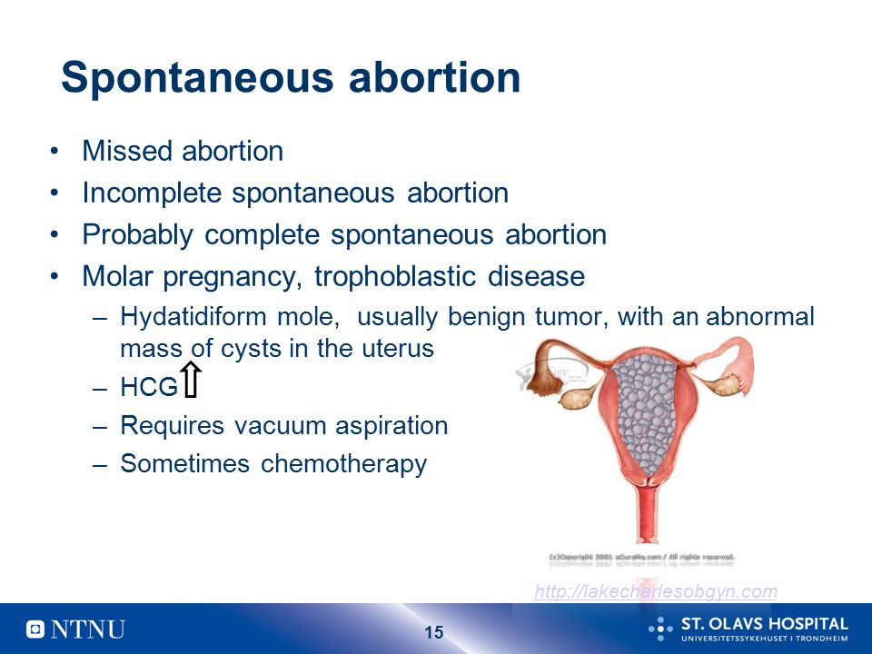 Spontaneous abortion Missed abortion Incomplete spontaneous abortion.