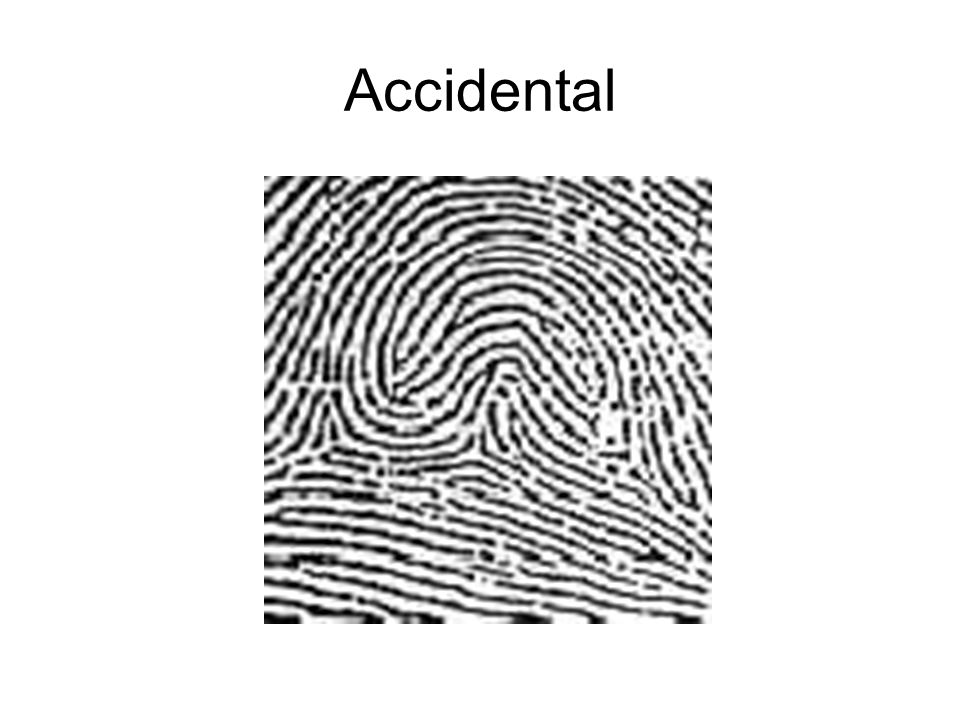 Accidental Fingerprint
