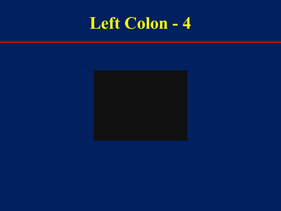 Left Colon - 4