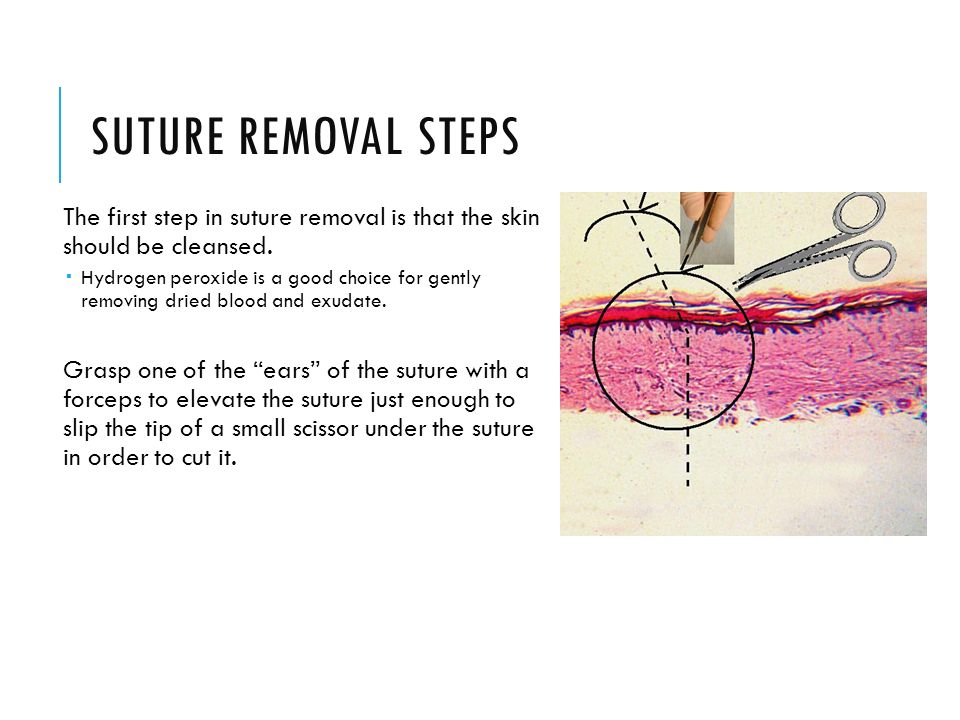 PPT - Section 21 SURGERY PowerPoint Presentation, free download - ID:2972310