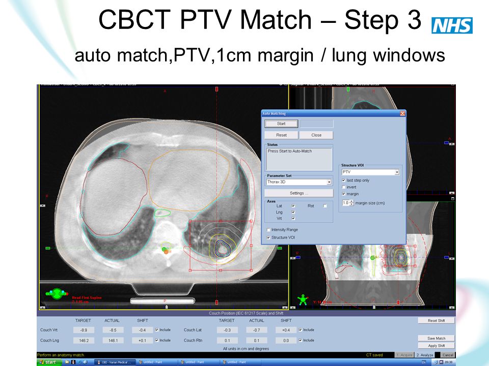 CBCT PTV Match – Step 3 auto match,PTV,1cm margin / lung windows