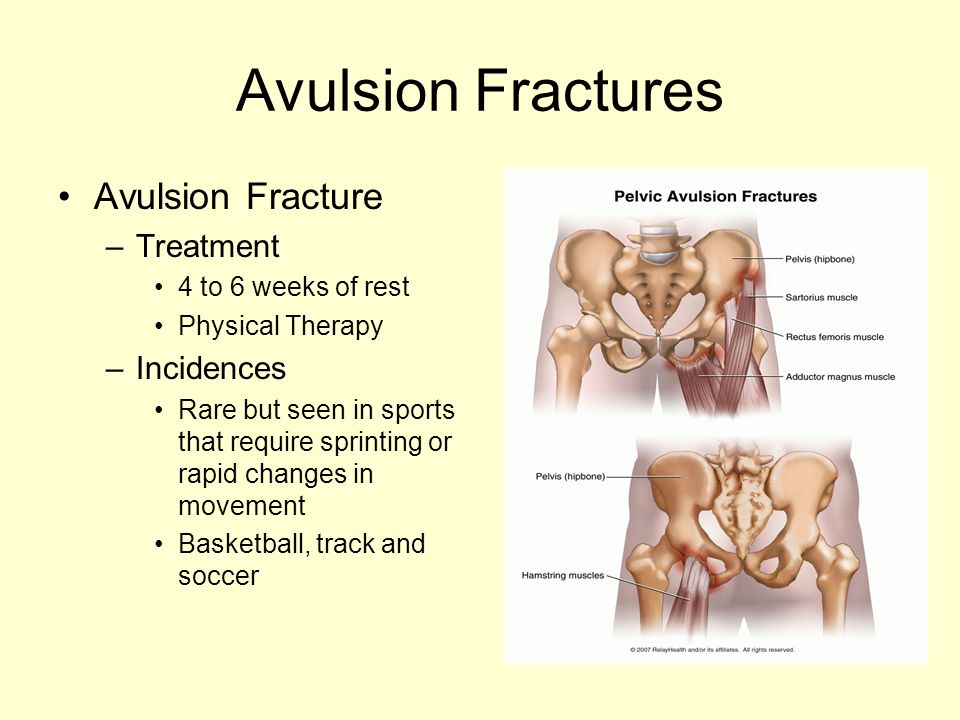 Injuries To Pelvis And Hip Ppt Download