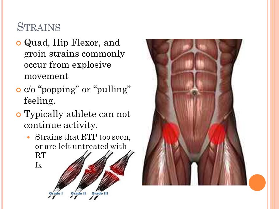 Strains Quad, Hip Flexor, and groin strains commonly occur from explosive m...