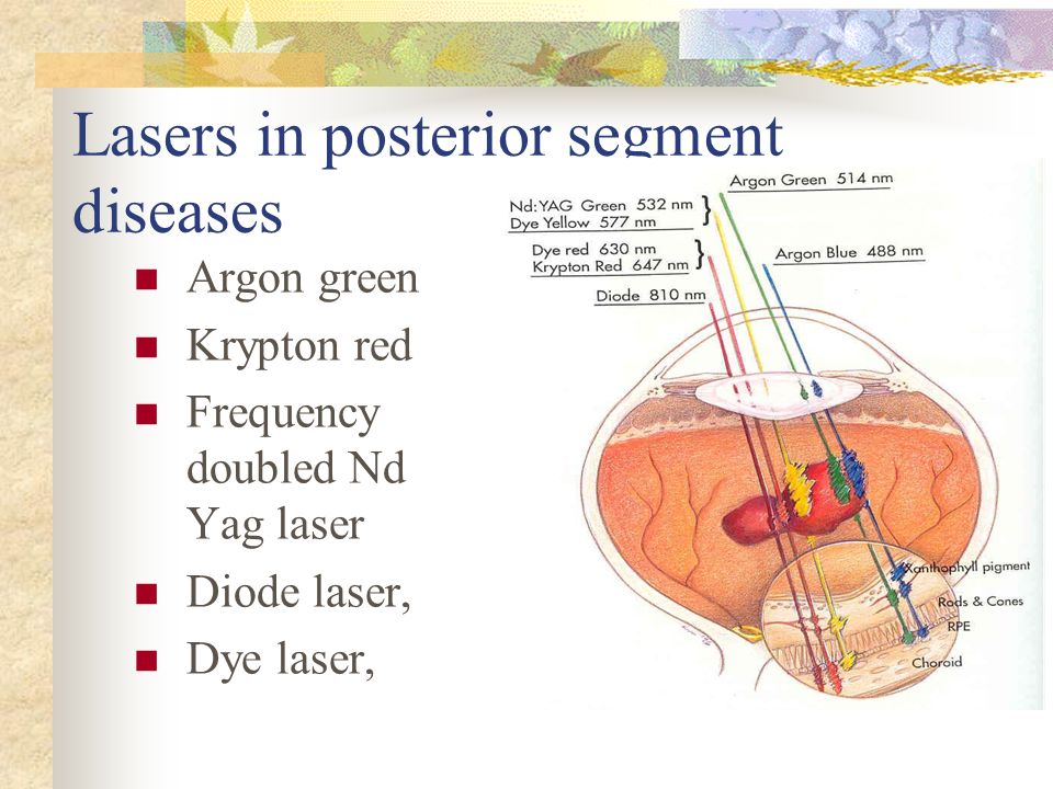 LASERS IN OPHTHALMOLOGY - ppt download