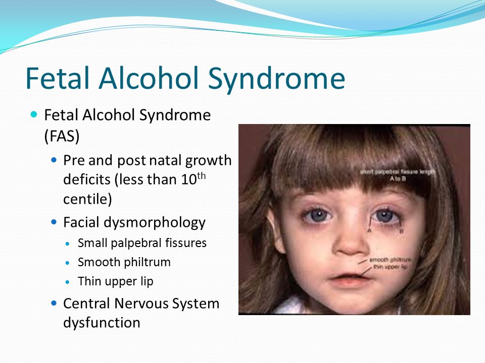 Реферат: Fetal Alcohol Syndrome And Fetal Alcohol Effects