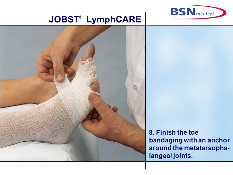 Compression Bandaging For The Leg With Lymphoedema Ppt Video Online Download