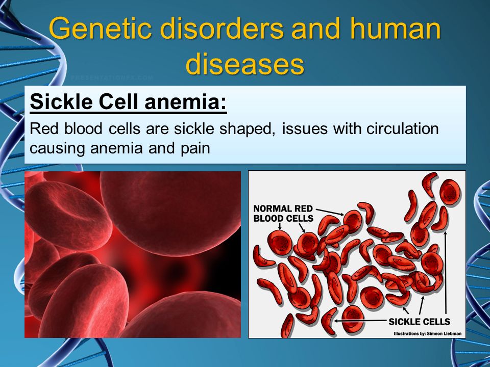 Human disease. Genetic Disorder.
