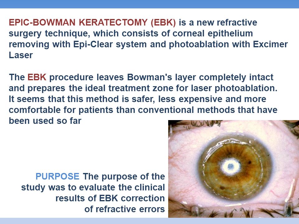 THE EBK PROCEDURE FOR CORRECTION OF REFRACTIVE ERRORS - ppt video online  download