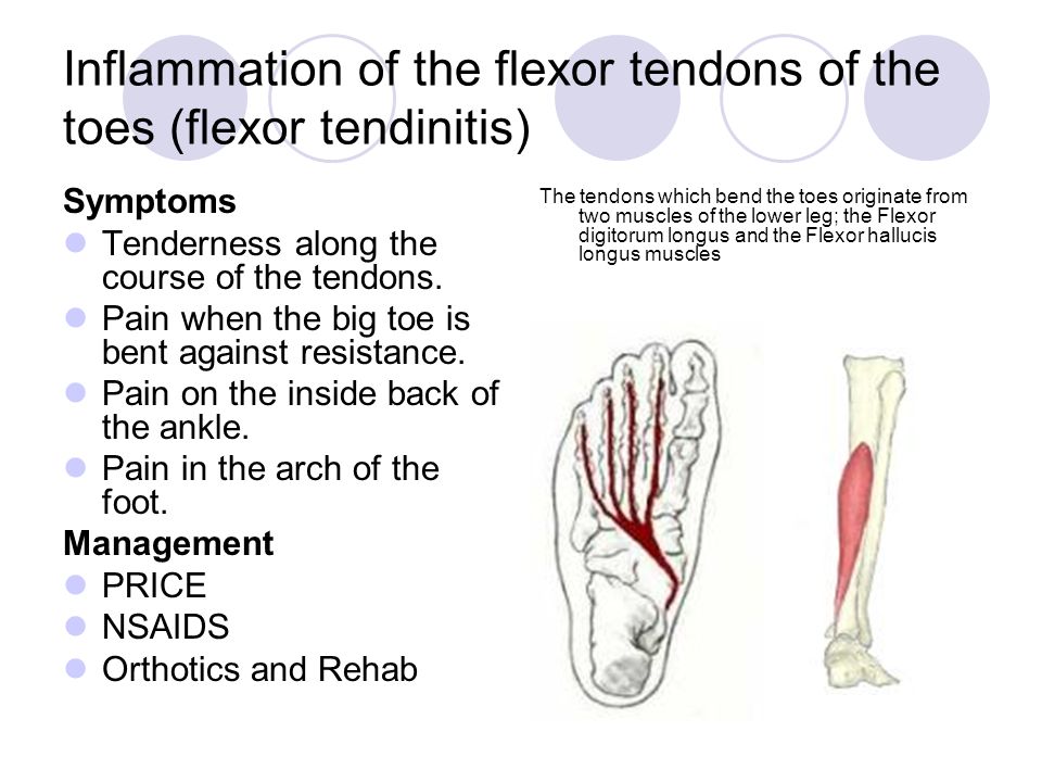 Overview Of Lower Extremity Evia Nano November 19 Ppt Video Online Download