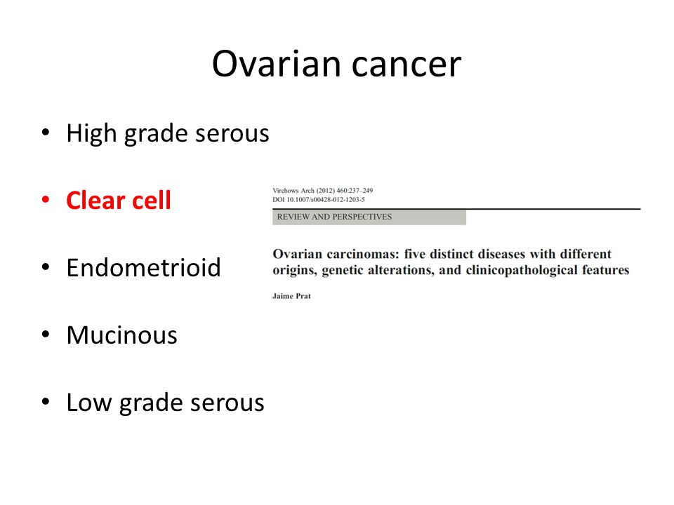 Ovarian cancer High grade serous Clear cell Endometrioid Mucinous