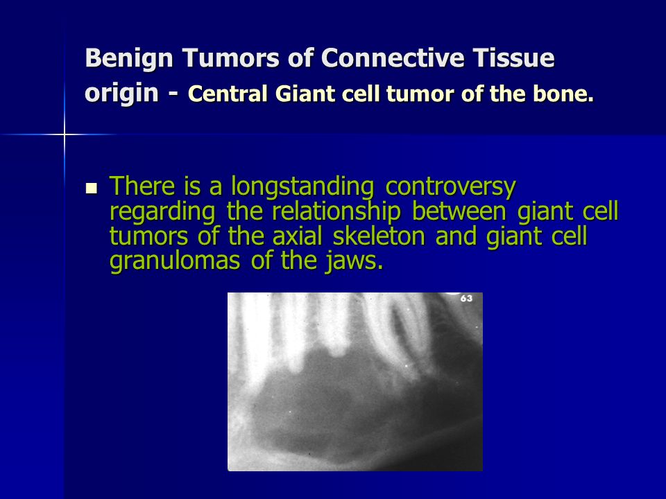 Benign Tumors of Connective Tissue origin - Central Giant cell tumor of the bone.