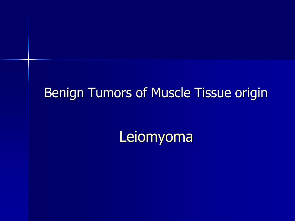 Benign Tumors of Muscle Tissue origin