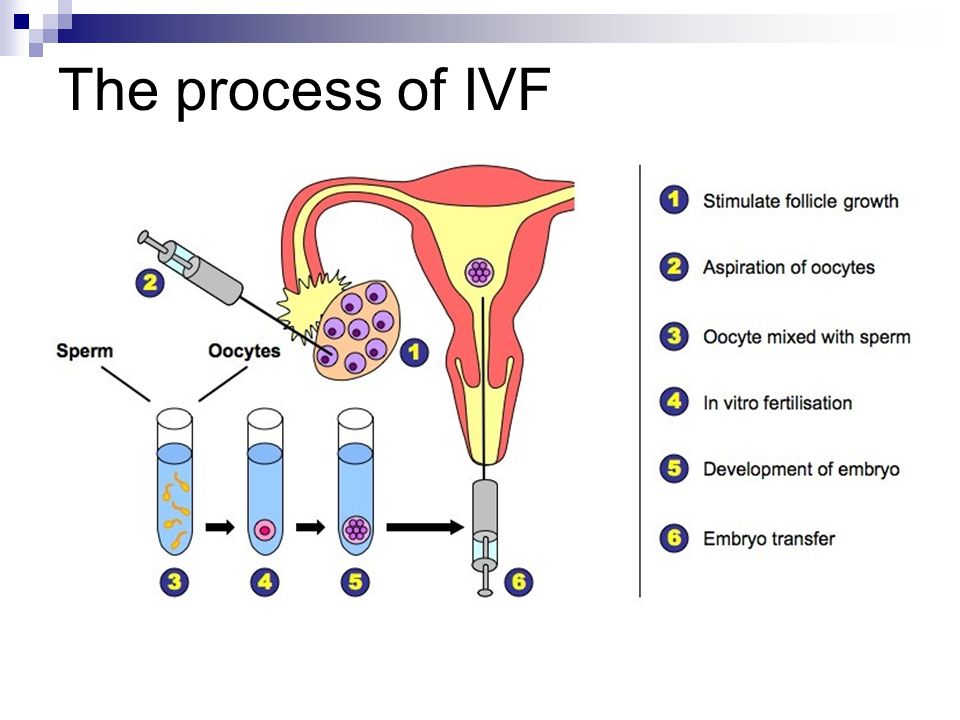 The Steps And Decisions In The Ivf Process