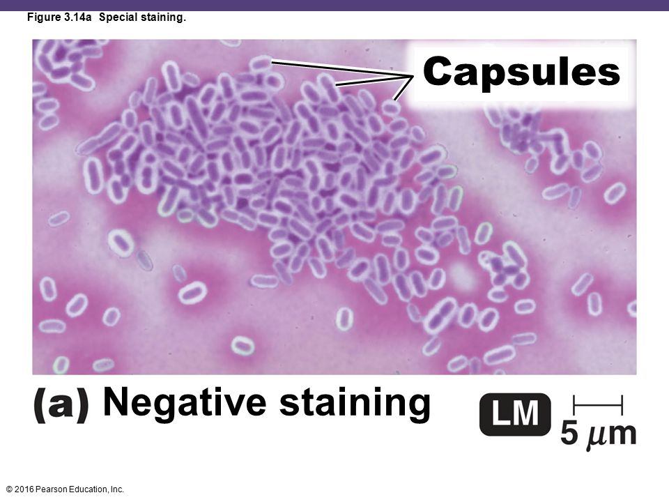 Figure 3.14a Special staining.