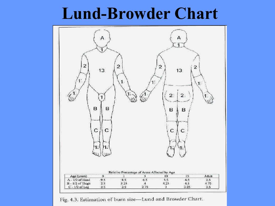 Lund And Browder Chart Explained