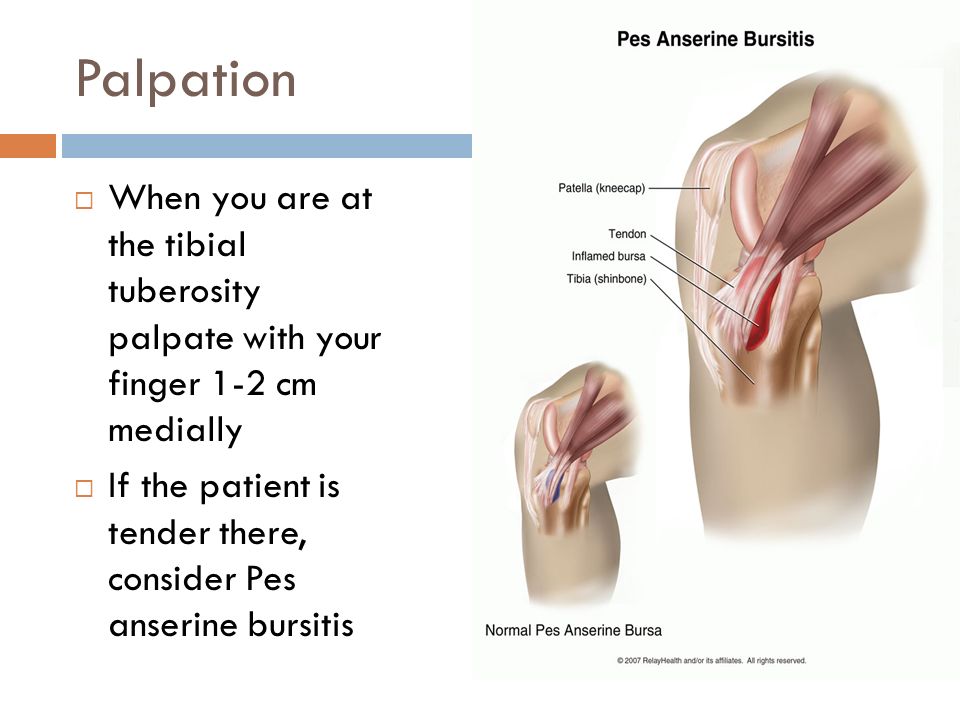The Examination Of The Knee Echo Sports Medicine 4 7 Ppt Video Online Download
