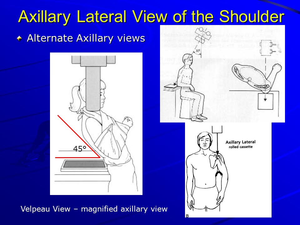 Presentation on theme: "X-Ray Rounds: (Plain) Radiographic Evaluation ...
