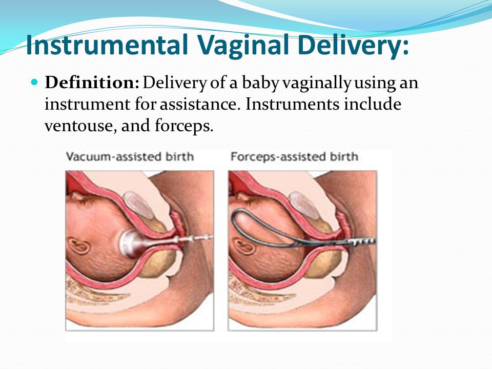 Deliveries and newborns