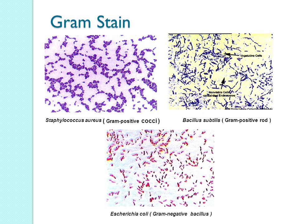 Observation Of Bacteria Using Staining Procedures Ppt Video Online Download